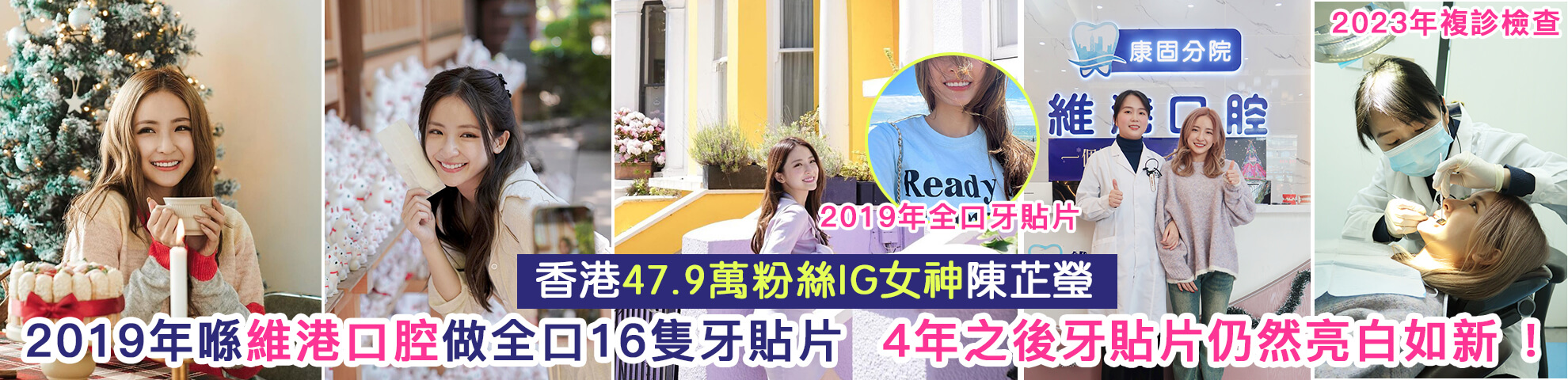 ig女神維港睇牙 ig女神維港睇牙