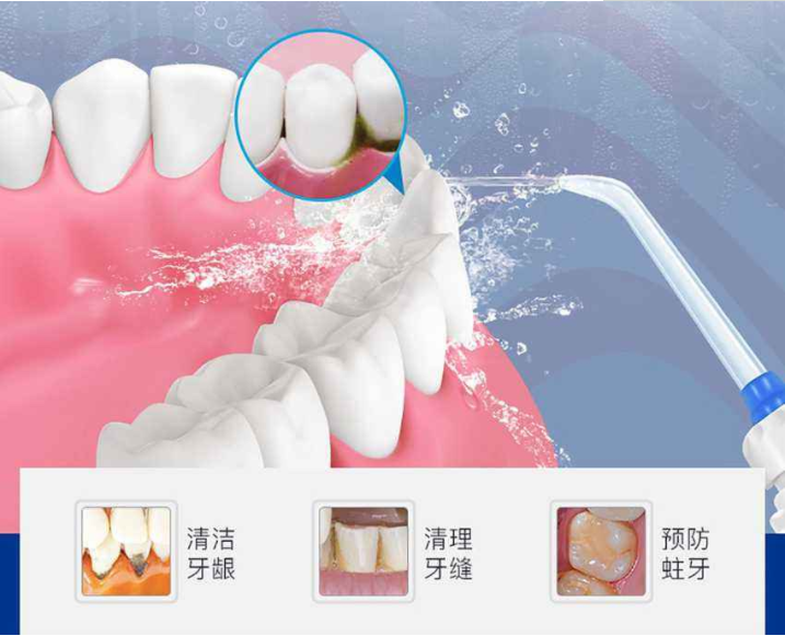 深圳維港洗牙 深圳維港洗牙