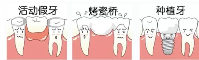镶牙究竟该怎么选择 镶牙究竟该怎么选择