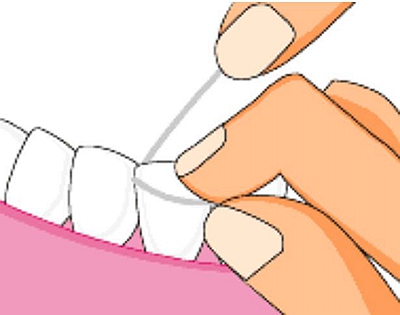 牙線正確使用 牙線正確使用