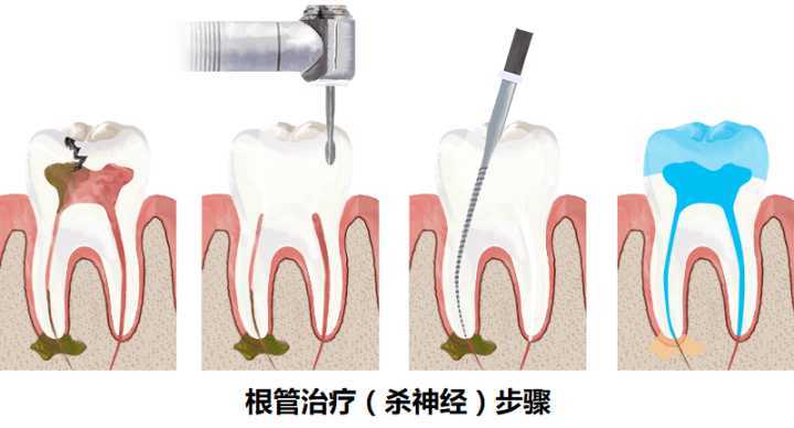二次杜牙根 二次杜牙根