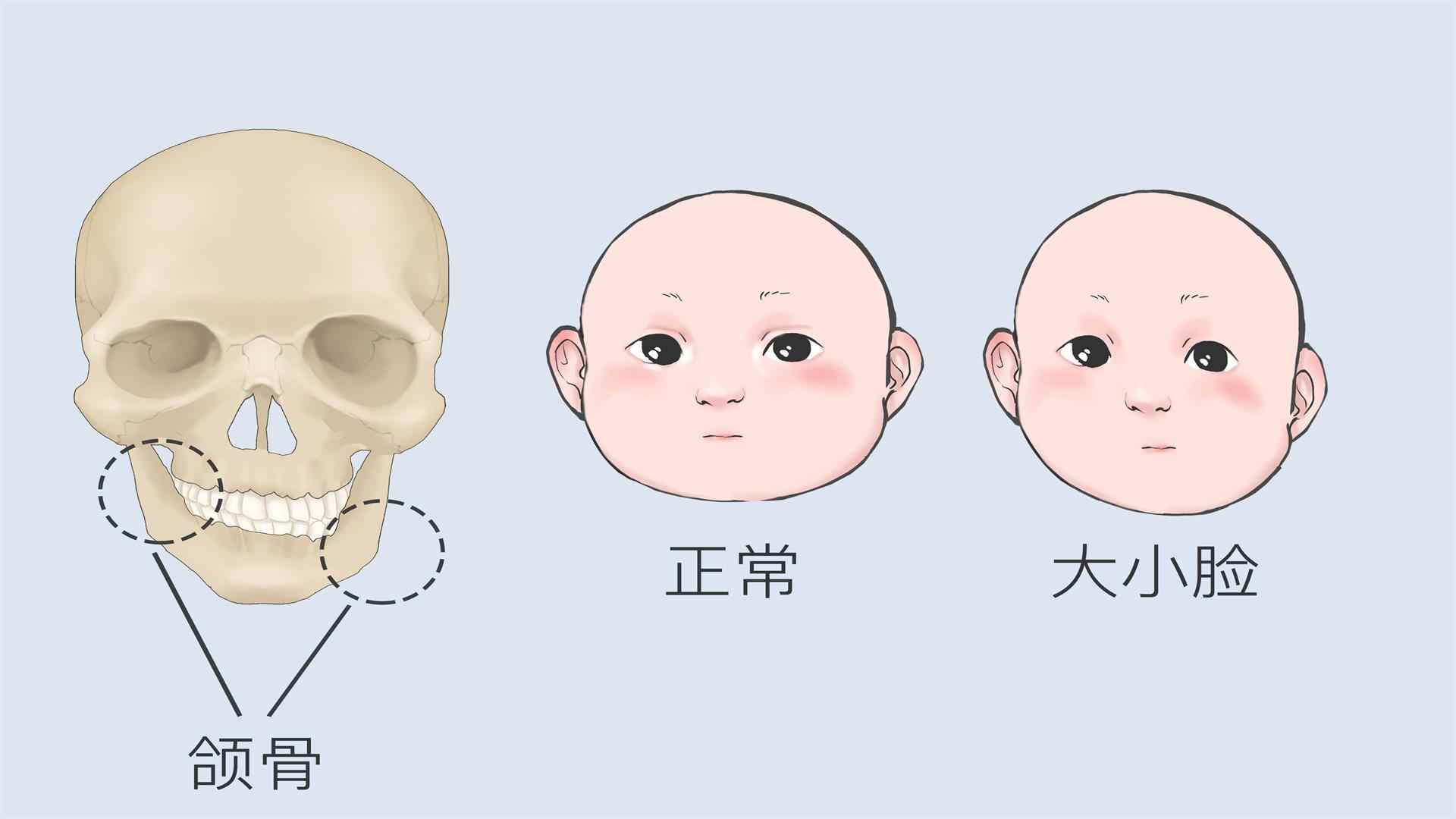 深圳牙科處理大小臉 深圳牙科處理大小臉