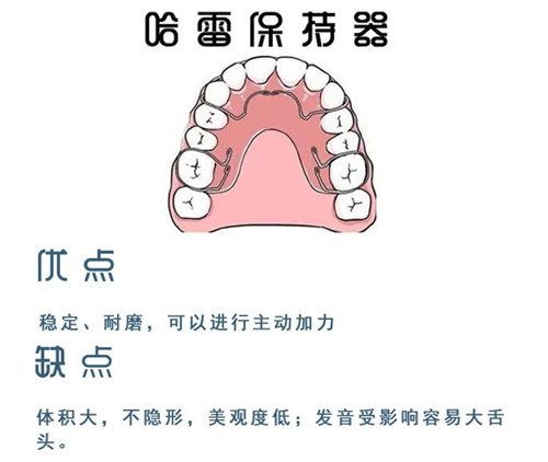 哈雷保持器 哈雷保持器