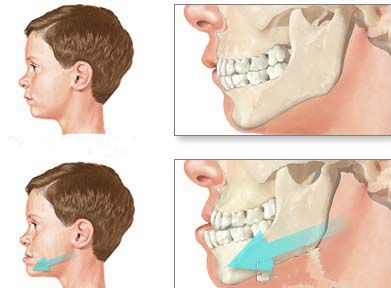 src=http-%2F%2Fcs.ybskq.cn%2Fuploads%2F180716%2F11-1PG6163K1219.jpg&refer=http-%2F%2Fcs.ybskq.jpg src=http-%2F%2Fcs.ybskq.cn%2Fuploads%2F180716%2F11-1PG6163K1219.jpg&refer=http-%2F%2Fcs.ybskq.jpg