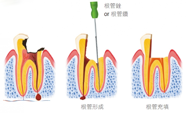 杜牙根7 杜牙根7