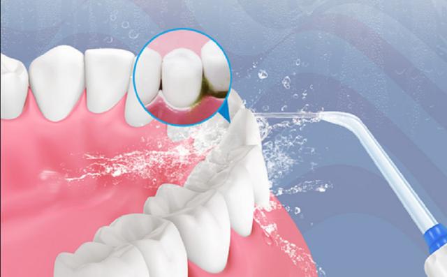 洗牙 (2) 洗牙 (2)