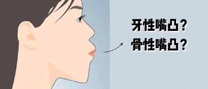 图片1 图片1