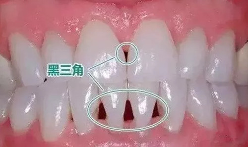 640_副本 640_副本