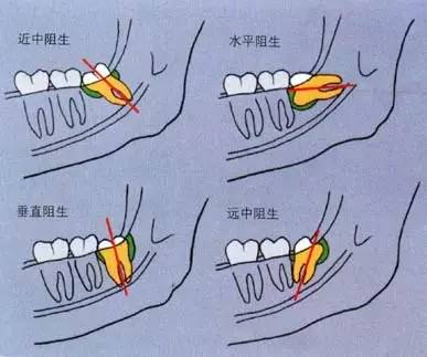 2fe1429ccfb44e43968ee99c1f8e4b40_th 2fe1429ccfb44e43968ee99c1f8e4b40_th