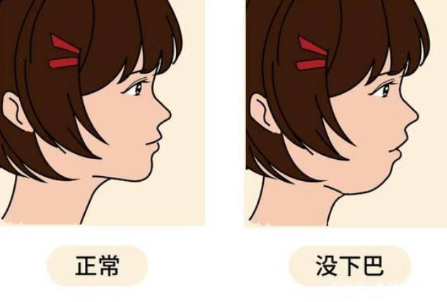 深圳牙齒矯正推介