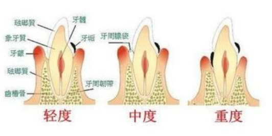 深圳牙科推介 深圳牙科推介