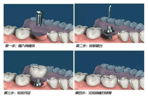 深圳维港口腔 深圳维港口腔