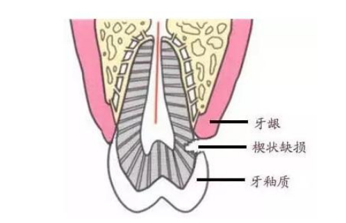 深圳補牙醫院推介