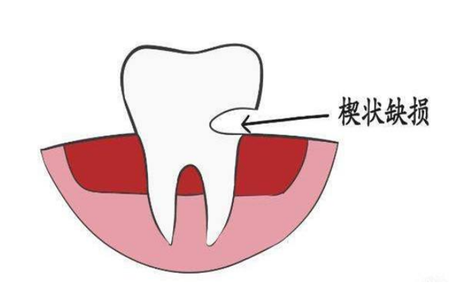 深圳牙科推介