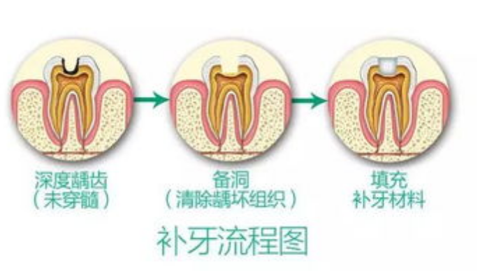 深圳牙科 深圳牙科