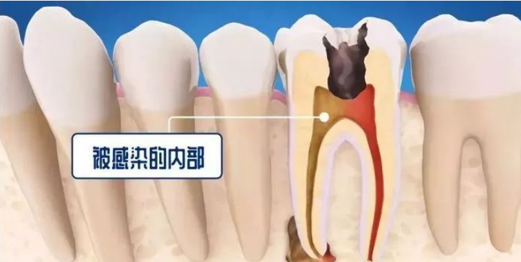 深圳杜牙根 深圳杜牙根