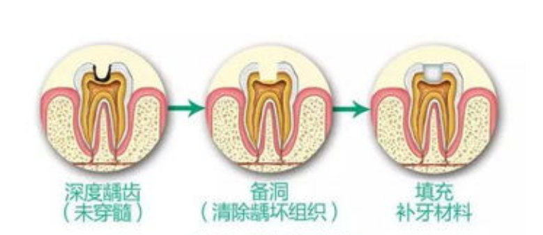 深圳牙科 深圳牙科