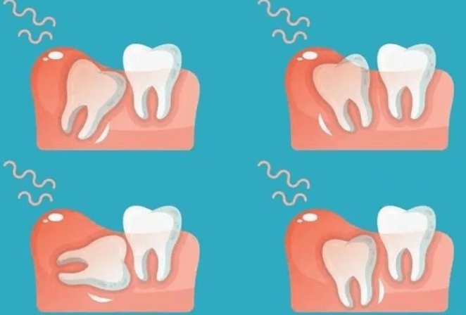 深圳牙科 深圳牙科