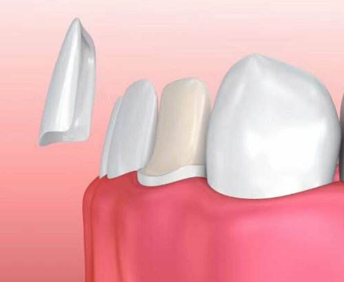 深圳维港口腔连锁