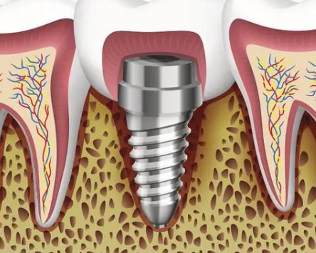 深圳维港口腔连锁