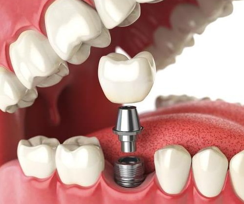 深圳维港口腔连锁