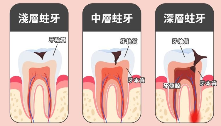 深圳杜牙根 深圳杜牙根