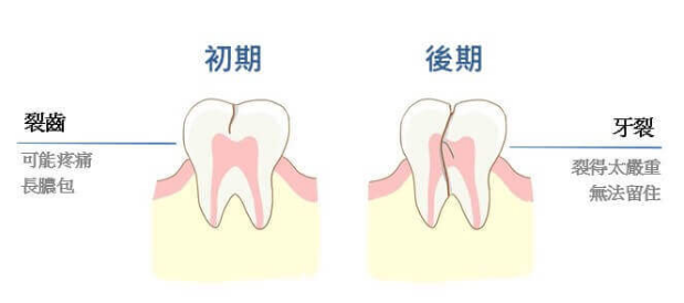 深圳杜牙根價格 深圳杜牙根價格