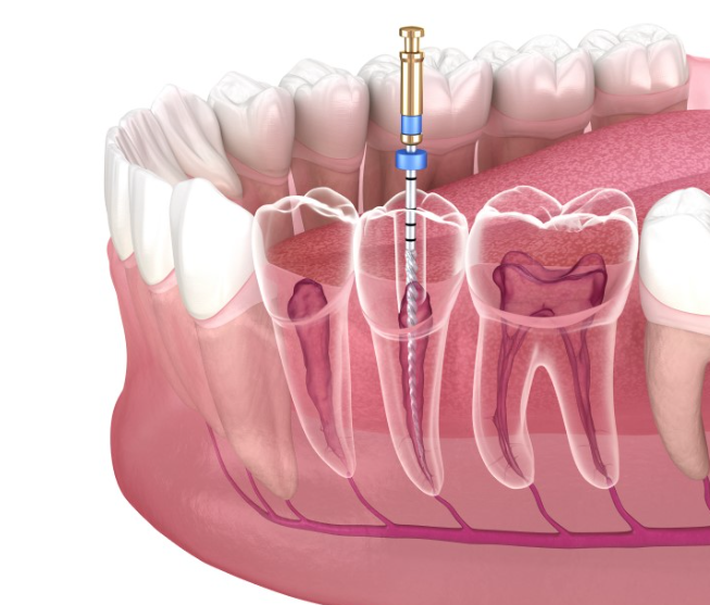 1727346293152.png 1727346293152.png
