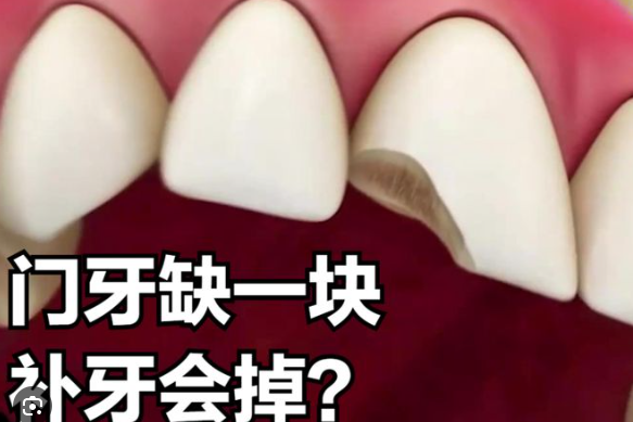 深圳牙科 深圳牙科
