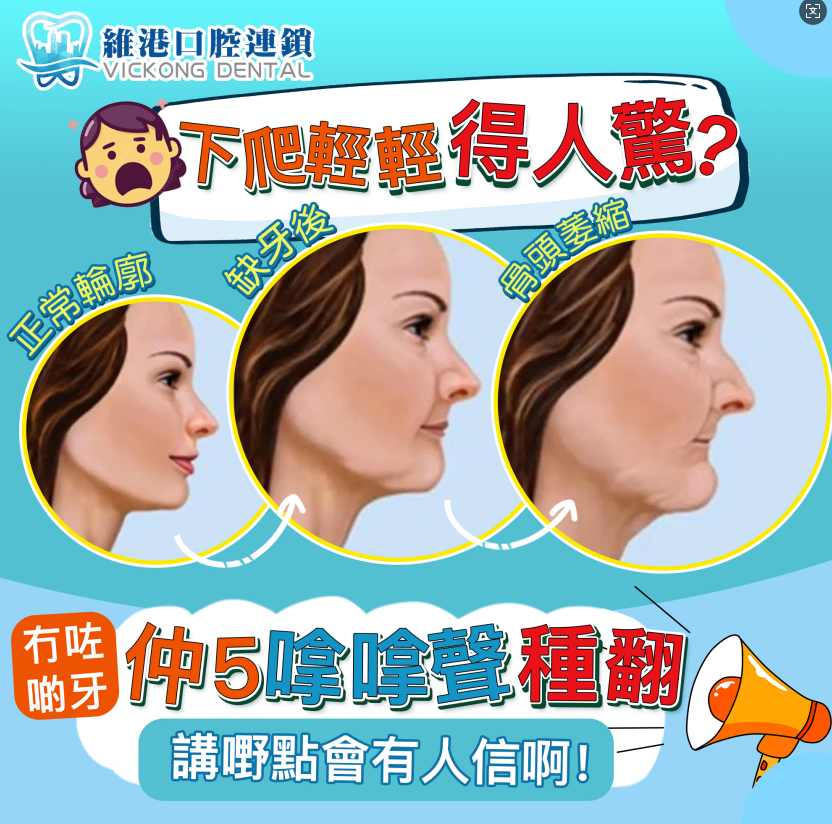 深圳維港口腔種植牙 深圳維港口腔種植牙