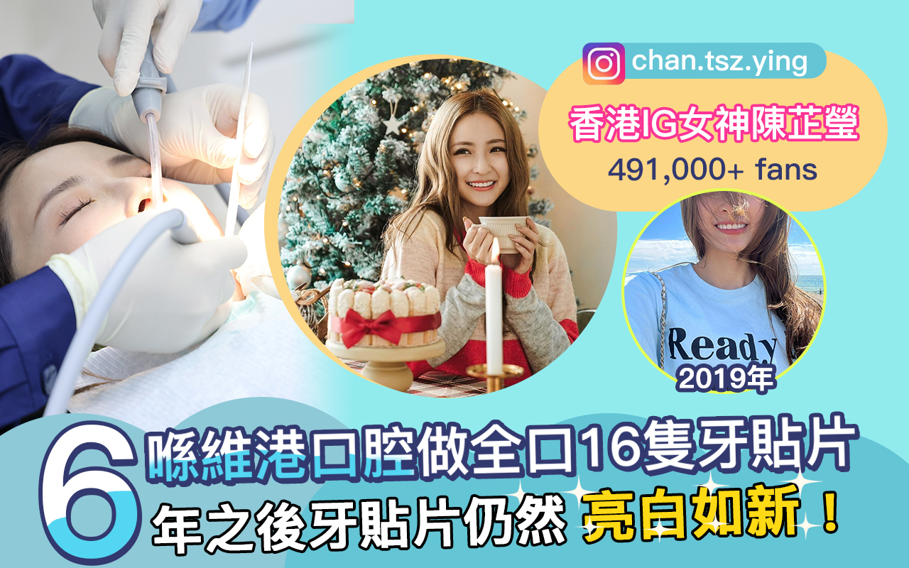 維港口腔牙貼片