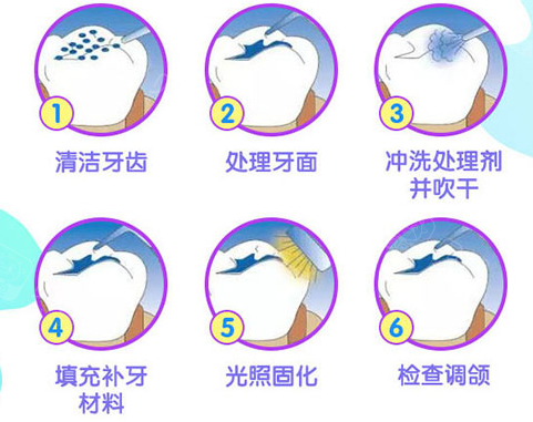 深圳补牙 深圳补牙