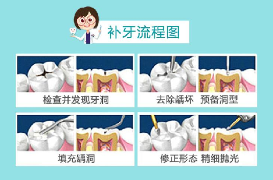深圳維港口腔補牙流程 深圳維港口腔補牙流程