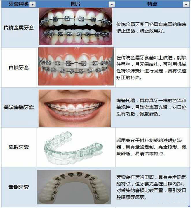 深圳箍牙,牙套種類 深圳箍牙,牙套種類