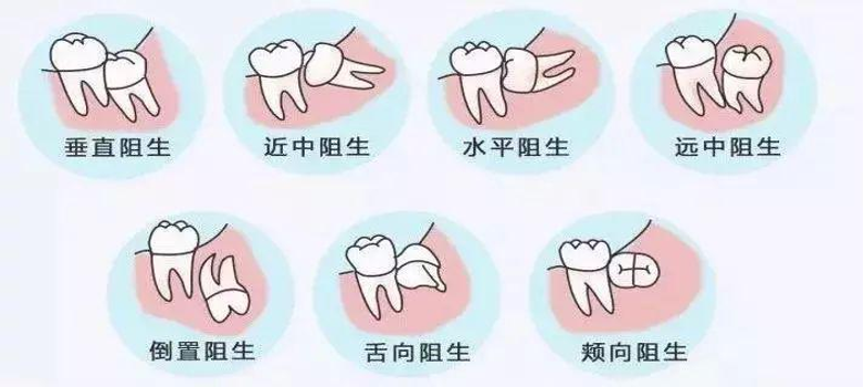 需要拔掉的 需要拔掉的