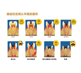 蛀牙的發病過程