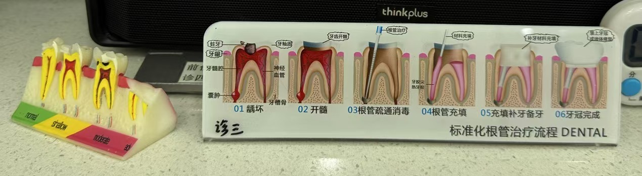 根管治療的過程