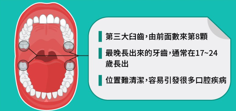 智齒是咩