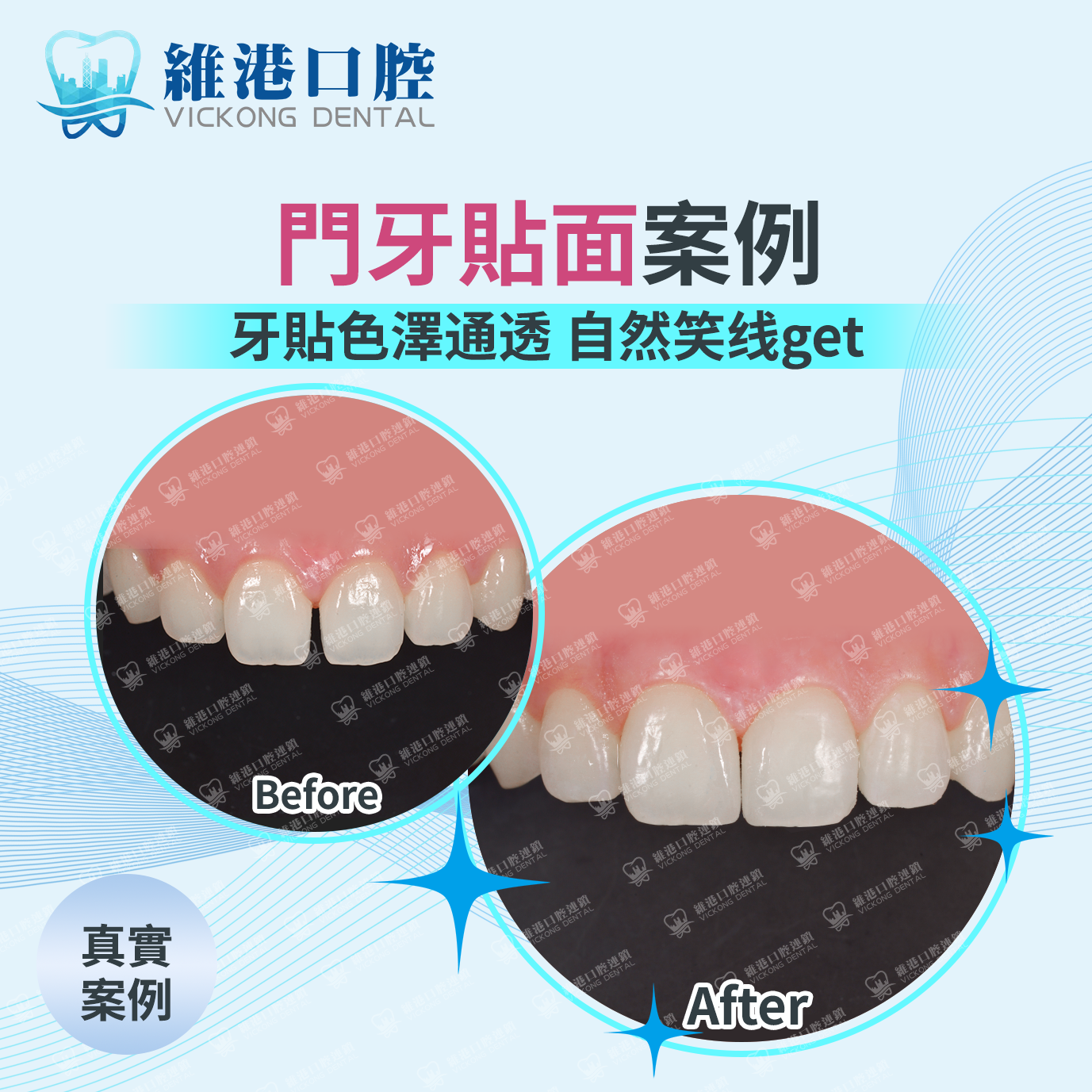 維港口腔 維港口腔