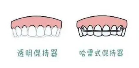 保持器 保持器