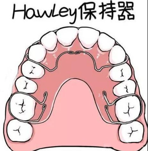哈雷保持器 哈雷保持器