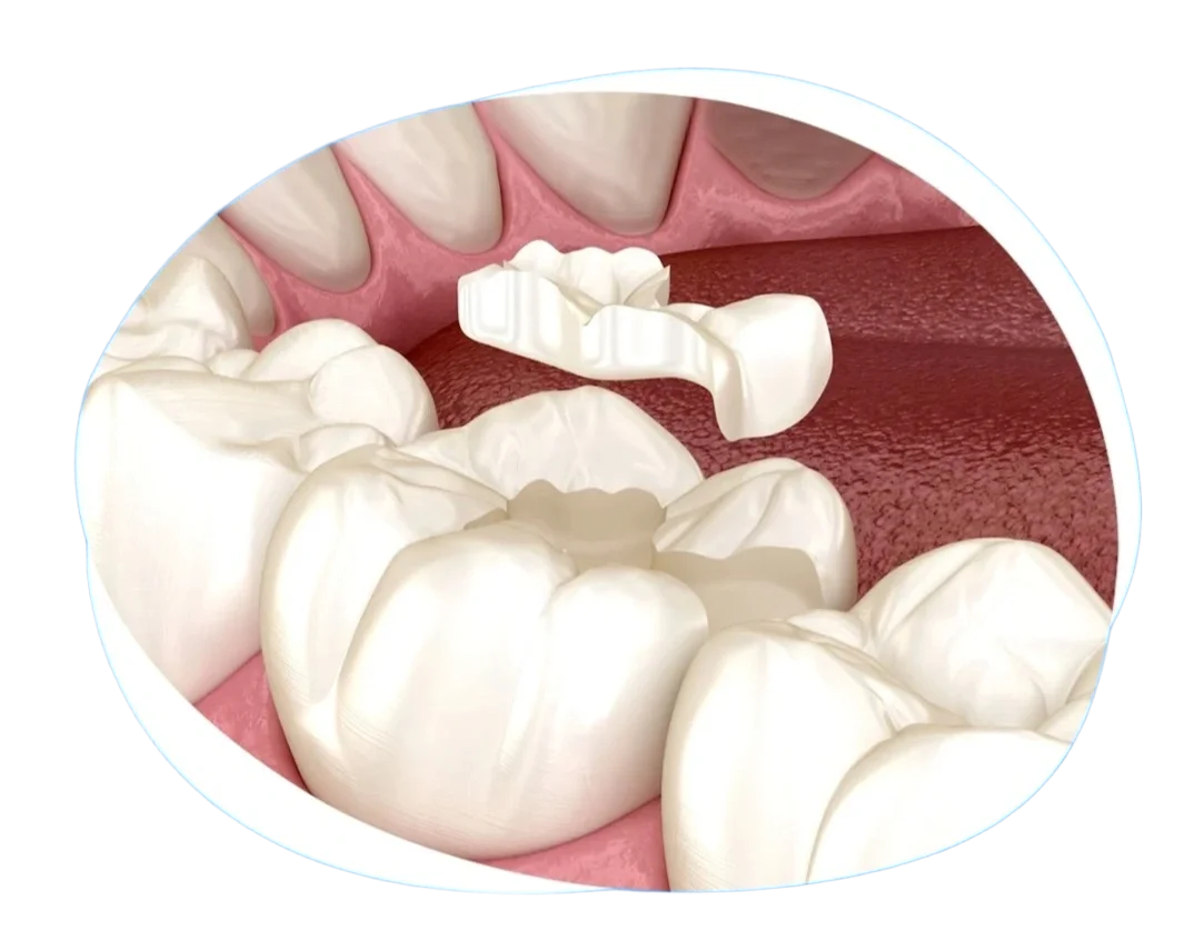 9b71e16f-7ca0-4645-8e81-0bc54183b4d7