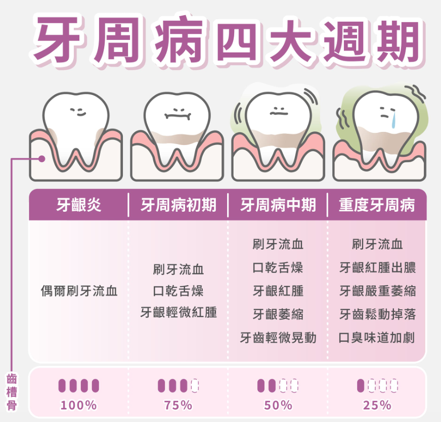 牙周病四大週期