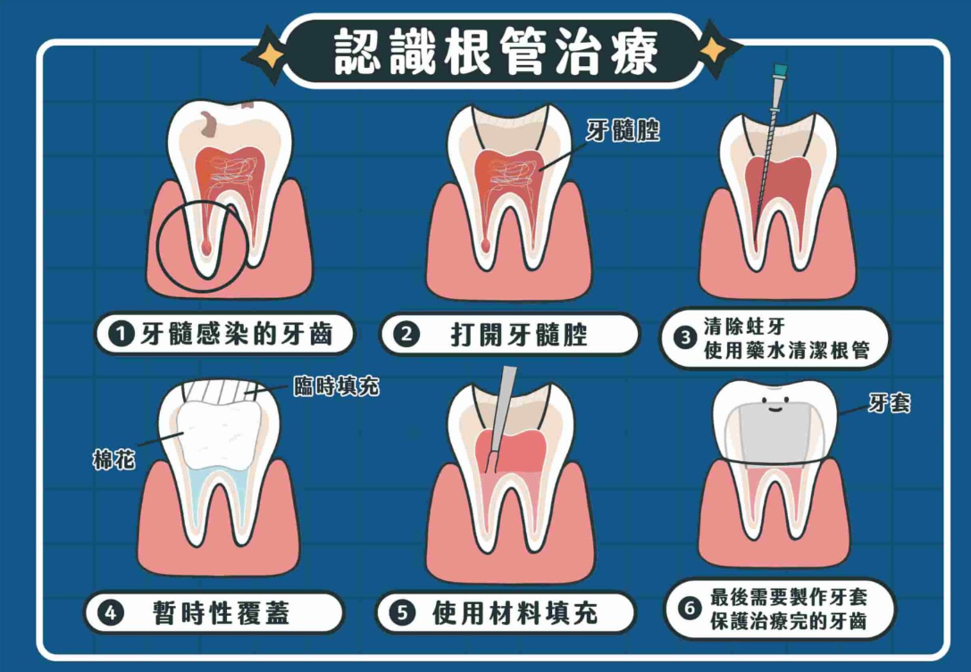 深圳杜牙根