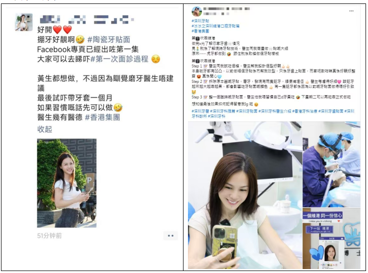 深圳牙贴片