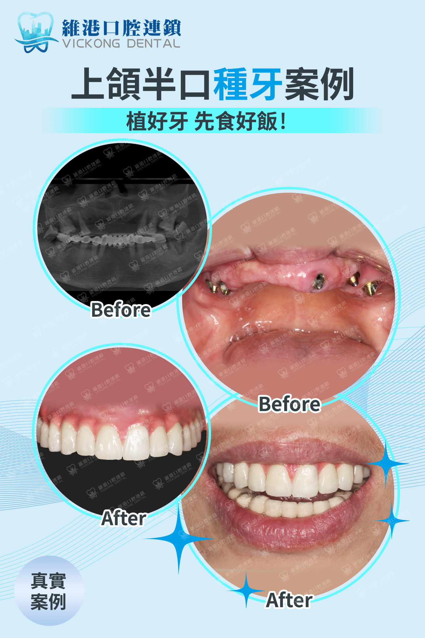 維港口腔 維港口腔