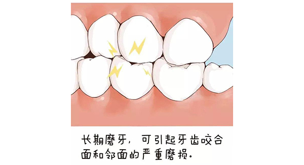 夜磨牙